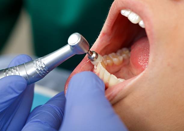 Best Dental Care Clinic in Indirapuram