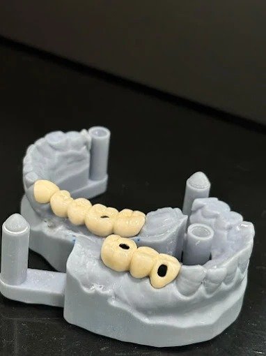 Best Complete Dental Care in Indirapuram