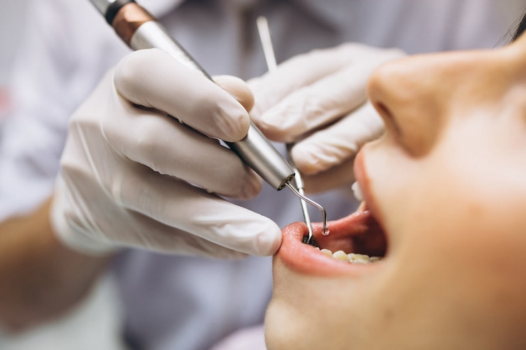Best Dentist in Indirapuram?
