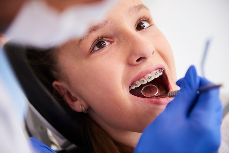 Best Orthodontic Treatment in Indirapuram