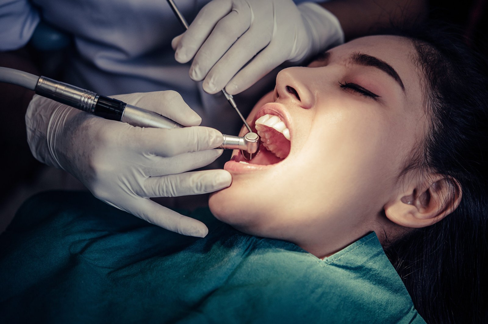 Dentist performing root canal procedure at the best dental clinic in Vasundhara.