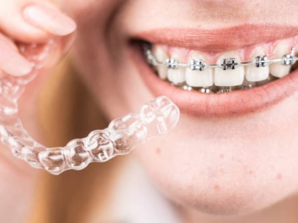 Dental care.Smiling happy girl with braces on her teeth holds aligners in her hands and shows the difference between them