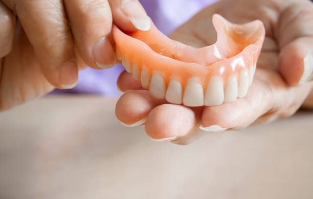 An elderly woman holds a denture. A woman is holding dentures in her hands. Removable dentures flexible. False teeth. Implant. Orthodontics. Old age. Teeth. Jaw. The close plan. Removable denture