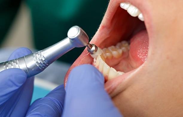 Close up of a professional dental brushing at the clinic