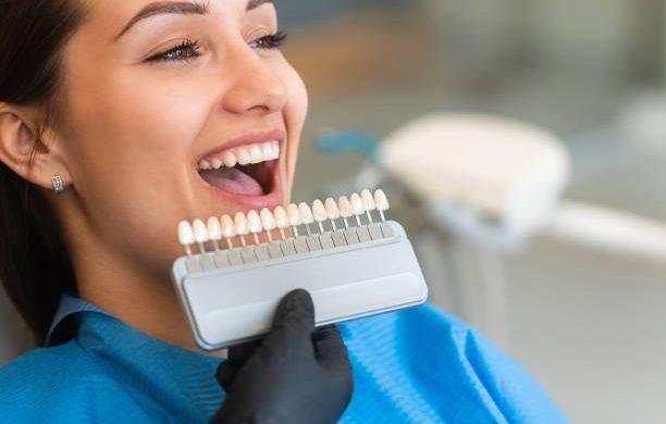 A beautiful young patient uses a dental tooth shade guide for whitening teeth service to ensure a perfect choice of color. Bleaching, prosthetics, orthopedic dentistry concept.
